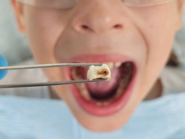 Best Pediatric Emergency Dentist in Ddleville, MI